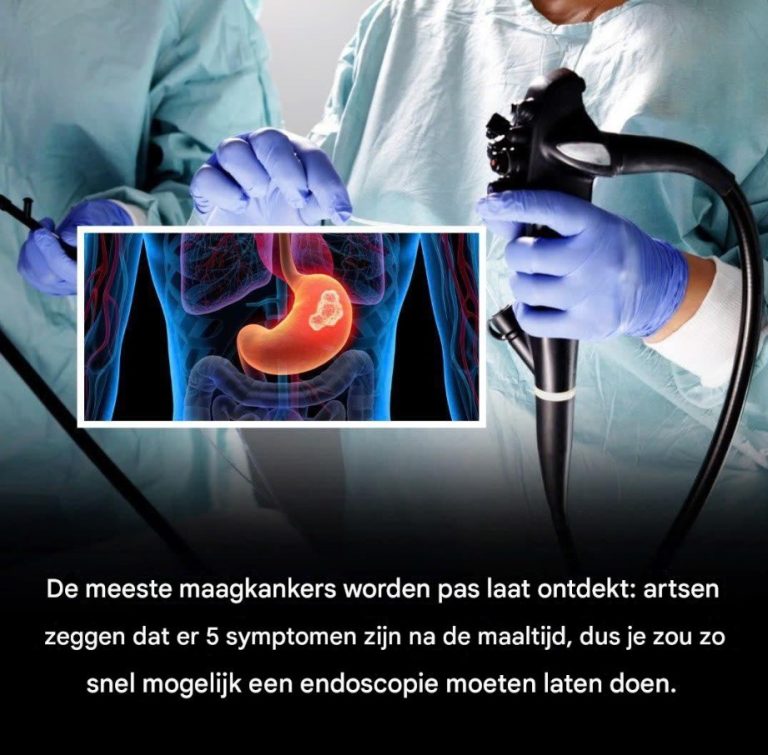 De meeste gevallen van maagkanker worden te laat ontdekt.
