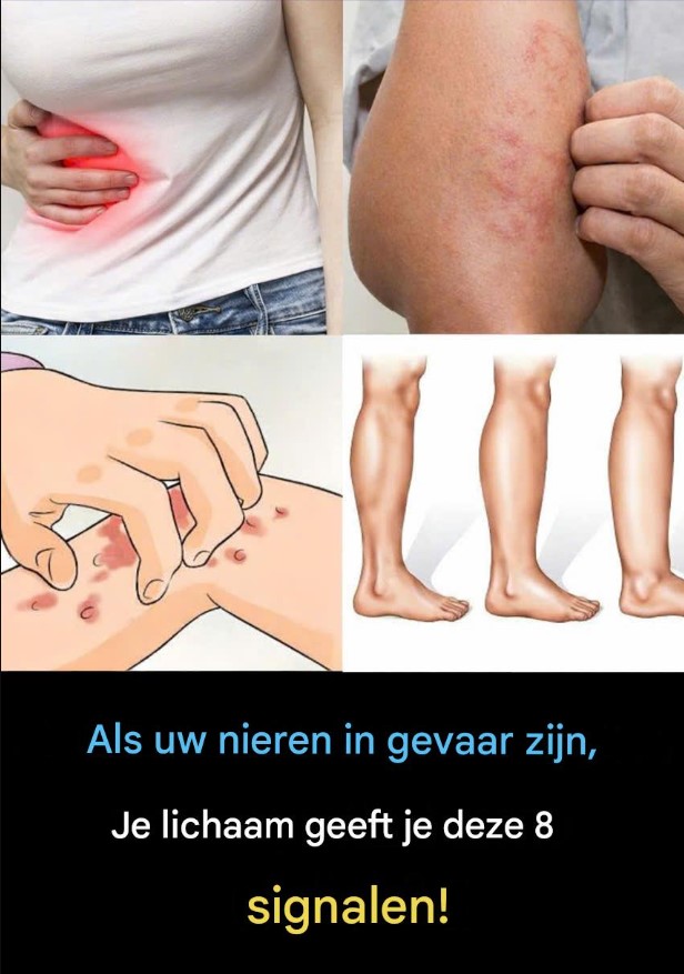 🩺 Als je nieren in gevaar zijn, waarschuwt je lichaam je met deze 8 signalen.