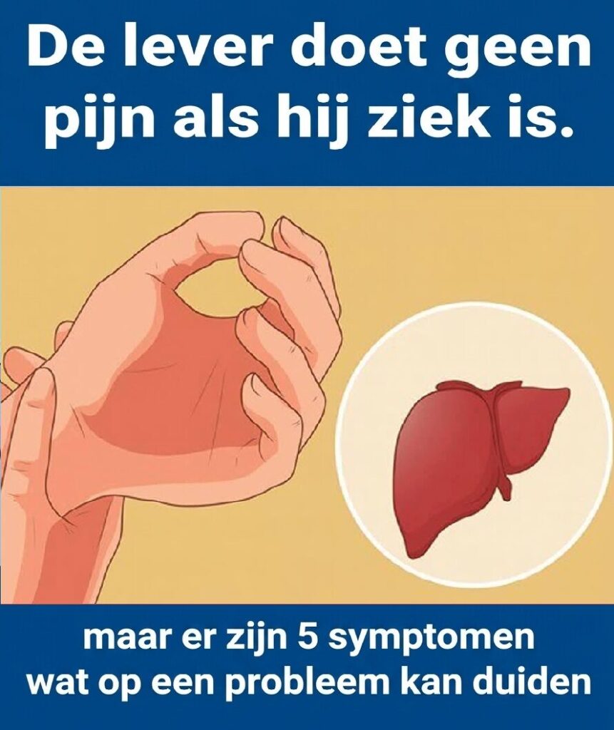 Een zieke lever veroorzaakt geen pijn, maar er zijn 5 symptomen die kunnen wijzen op een leverprobleem.