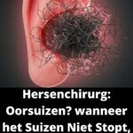 Save draft Dichtzittende Oren? De Simpele Oplossing Die Je Al In Huis Hebt Maar Nooit Gebruikt